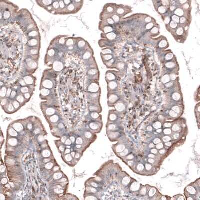 Immunohistochemistry-Paraffin: TMEM2 Antibody [NBP1-94168] - Staining of human small intestine shows moderate positivity in apical membranes in glandular cells.