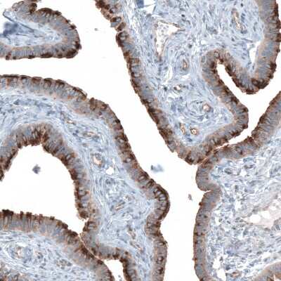 Immunohistochemistry-Paraffin: TMEM2 Antibody [NBP1-94168] - Staining of human Fallopian tube shows strong positivity in apical membrane in glandular cells.