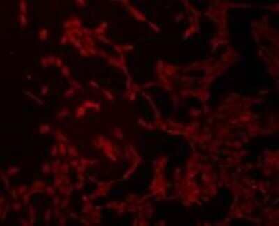 Immunocytochemistry/Immunofluorescence: TMEM200A Antibody (4-B3) [NBP2-67214] - Staining of NIH/3T3 cells using anti-TMEM200A Mouse mAb.