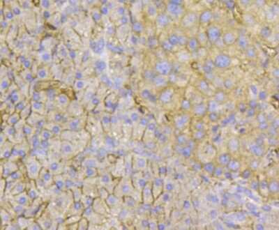 Immunohistochemistry-Paraffin: TMEM200A Antibody (4-B3) [NBP2-67214] - Immunohistochemical analysis of paraffin-embedded human pancreas tissue using anti-TMEM200A antibody. Counter stained with hematoxylin.