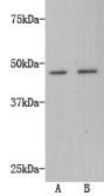 Western Blot: TMEM200A Antibody (4-B3) [NBP2-67214] - Analysis on A:A549,B:HepG2 cell lysates using anti-TMEM200A Mouse mAb.