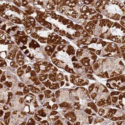 Immunohistochemistry-Paraffin: TMEM200C Antibody [NBP2-30838] - Staining of human stomach, upper shows strong cytoplasmic positivity in glandular cells.