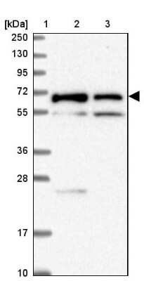 Western Blot: TMEM200C Antibody [NBP2-30838] - Lane 1: Marker [kDa] 250, 130, 95, 72, 55, 36, 28, 17, 10Lane 2: Human cell line RT-4Lane 3: Human cell line U-251MG sp