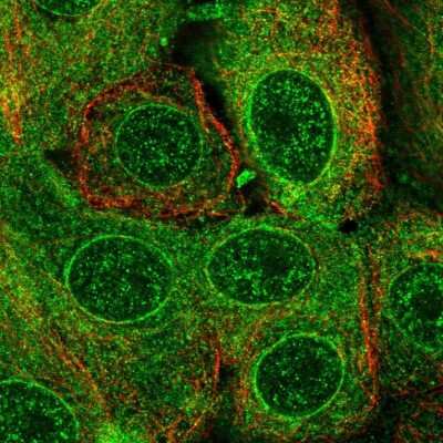 Immunocytochemistry/Immunofluorescence: TMEM205 Antibody [NBP1-81255] - Staining of human cell line MCF7 shows localization to nucleoplasm, nuclear membrane & endoplasmic reticulum. Antibody staining is shown in green.