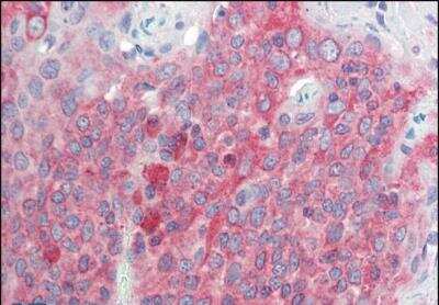 Immunohistochemistry-Paraffin: TMEM205 Antibody [NBP1-52110] - (5ug/ml) staining of paraffin embedded Human Tonsil. Steamed antigen retrieval with citrate buffer pH 6, AP-staining.