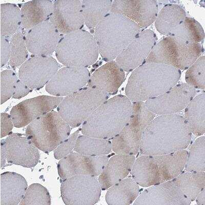 Immunohistochemistry-Paraffin: TMEM205 Antibody [NBP1-81255] - Staining of human skeletal muscle shows very weak positivity in myocytes as expected.