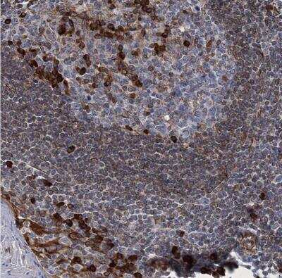 Immunohistochemistry-Paraffin: TMEM205 Antibody [NBP1-81255] - Staining of human tonsil shows strong cytoplasmic positivity in germinal center cells.