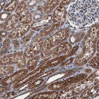 Immunohistochemistry-Paraffin: TMEM205 Antibody [NBP1-81255] - Staining of human kidney shows moderate to strong cytoplasmic positivity in cells in tubules.