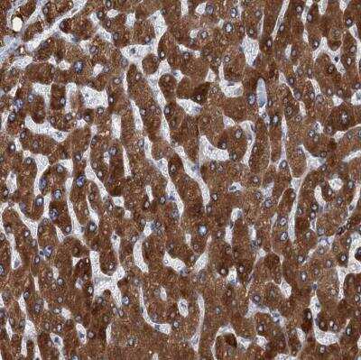 Immunohistochemistry-Paraffin: TMEM205 Antibody [NBP1-81255] -  Staining of human liver shows strong cytoplasmic positivity in hepatocytes.