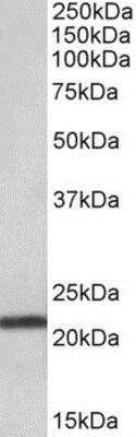 Western Blot: TMEM205 Antibody [NBP1-52110] (0.03ug/ml) staining of Human Pancreas lysate (35ug protein in RIPA buffer). Primary incubation was 1 hour. Detected by chemiluminescence.