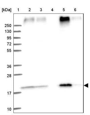 Western Blot: TMEM205 Antibody [NBP1-81255] - Lane 1: Marker  [kDa] 250, 130, 95, 72, 55, 36, 28, 17, 10.  Lane 2: Human cell line RT-4.  Lane 3: Human cell line U-251MG sp.  Lane 4: Human plasma (IgG/HSA depleted).  Lane 5: Human liver tissue.  Lane 6: Human tonsil tissue