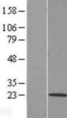 Western Blot: TMEM205 Overexpression Lysate (Adult Normal) [NBL1-17060] Left-Empty vector transfected control cell lysate (HEK293 cell lysate); Right -Over-expression Lysate for TMEM205.