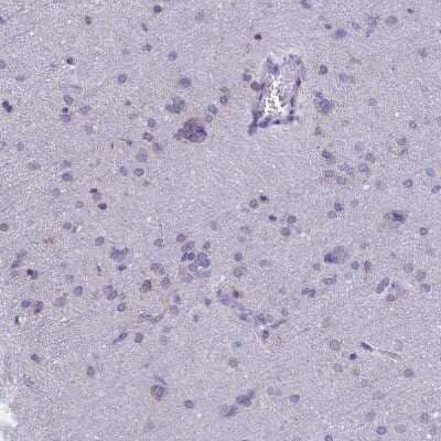 Immunohistochemistry-Paraffin: TMEM206 Antibody [NBP1-88325] - Staining of human Cerebral cortex shows very weak granular cytoplasmic positivity in neuronal cells.