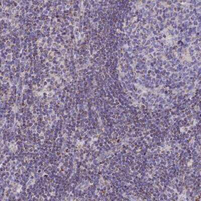 Immunohistochemistry-Paraffin: TMEM206 Antibody [NBP1-88325] - Staining of human Lymph node shows weak granular cytoplasmic  positivity in germinal and non-germinal center cells.
