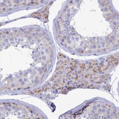 Immunohistochemistry-Paraffin: TMEM206 Antibody [NBP1-88325] - Staining of human Testis shows moderate granular cytoplasmic  positivity in Leydig cells.