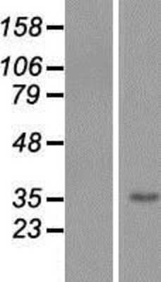Western Blot: TMEM206 Overexpression Lysate (Adult Normal) [NBP2-06837] Left-Empty vector transfected control cell lysate (HEK293 cell lysate); Right -Over-expression Lysate for TMEM206.