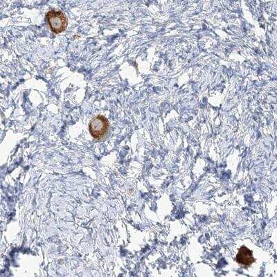 Immunohistochemistry: TMEM209 Antibody [NBP1-94004] - Staining of human ovary shows strong cytoplasmic positivity in follicle cells.