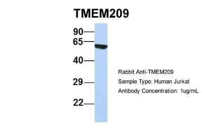 Western Blot: TMEM209 Antibody [NBP1-91493] - Human Jurkat, Antibody Dilution: 1.0 ug/ml TMEM209 is supported by BioGPS gene expression data to be expressed in Jurkat.