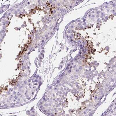 Immunohistochemistry-Paraffin: TMEM210 Antibody [NBP2-49498] - Staining of human testis shows high expression.