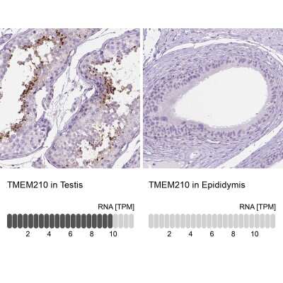 Immunohistochemistry-Paraffin: TMEM210 Antibody [NBP2-49498] - Staining in human testis and epididymis tissues using anti-TMEM210 antibody. Corresponding TMEM210 RNA-seq data are presented for the same tissues.