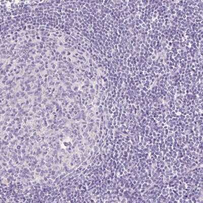 Immunohistochemistry-Paraffin: TMEM213 Antibody [NBP2-30616] - Staining of human lymph node shows low expression as expected.