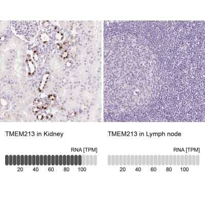 Immunohistochemistry-Paraffin: TMEM213 Antibody [NBP2-30616] - Staining in human kidney and lymph node tissues using anti-TMEM213 antibody. Corresponding TMEM213 RNA-seq data are presented for the same tissues.