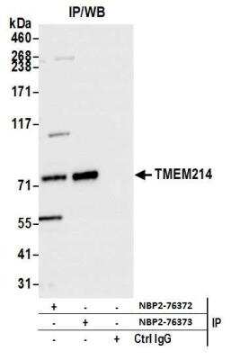 Immunoprecipitation: TMEM214 Antibody [NBP2-76373] - Samples: Whole cell lysate (1.0 mg per IP reaction; 20% of IP loaded) from Hep-G2 cells prepared using NETN lysis buffer. Antibodies: Affinity purified rabbit anti-TMEM214 antibody NBP2-76373 used for IP at 15 ul per reaction. TMEM214 was also immunoprecipitated by rabbit anti-TMEM214 antibody NBP2-76372. For blotting immunoprecipitated TMEM214, NBP2-76373 was used at 1:100. Detection: Chemiluminescence with an exposure time of 1 second.