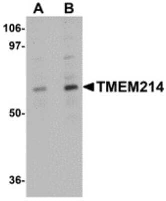 Western Blot TMEM214 Antibody - BSA Free