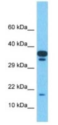 Western Blot: TMEM220 Antibody [NBP3-10581] - Western blot analysis of TMEM220 in Uterus Tumor lysates. Antibody dilution at 1.0ug/ml