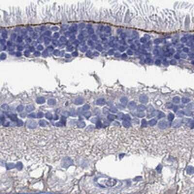 Immunohistochemistry-Paraffin: TMEM221 Antibody [NBP3-17551] - Staining of human retina shows strong positivity in outer limiting membrane.