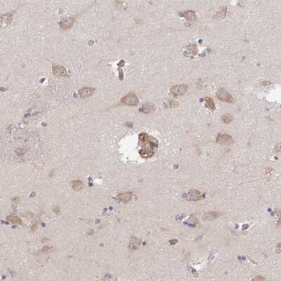 Immunohistochemistry-Paraffin: TMEM229A Antibody [NBP2-33783] - Staining of human lateral ventricle shows moderate cytoplasmic positivity in neuronal cells.