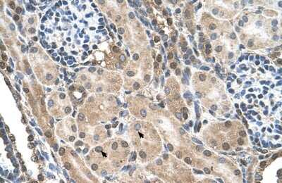 Immunohistochemistry-Paraffin TMEM231 Antibody