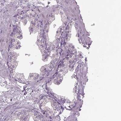 Immunohistochemistry-Paraffin: TMEM231 Antibody [NBP1-91905] - Staining of human prostate shows low expression as expected.