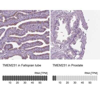 Immunohistochemistry-Paraffin: TMEM231 Antibody [NBP1-91905] - Staining in human fallopian tube and prostate tissues using anti-TMEM231 antibody. Corresponding TMEM231 RNA-seq data are presented for the same tissues.