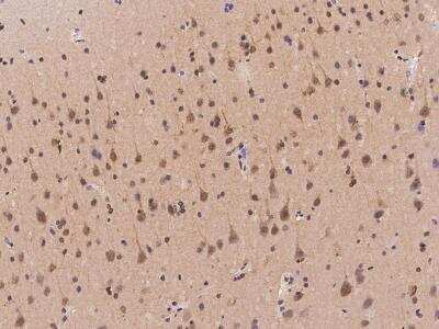 Immunohistochemistry-Paraffin: TMEM231 Antibody [NBP3-06280] - Immunochemical staining of human TMEM231 in human brain with rabbit polyclonal antibody at 1:500 dilution, formalin-fixed paraffin embedded sections.