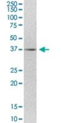 Western Blot: TMEM231 Antibody [H00079583-B01P] - Analysis of FLJ22167 expression in human kidney.