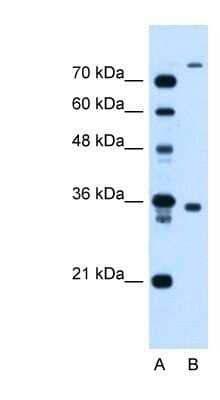 Western Blot TMEM231 Antibody