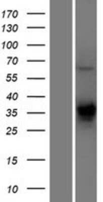 Western Blot: TMEM231 Overexpression Lysate (Adult Normal) [NBP2-11453] Left-Empty vector transfected control cell lysate (HEK293 cell lysate); Right -Over-expression Lysate for TMEM231.