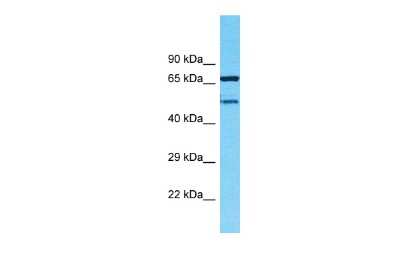 Western Blot: TMEM232 Antibody [NBP2-83686] - Host: Rabbit. Target Name: TMEM232. Sample Type: MDA-MB-435S Whole Cell lysates. Antibody Dilution: 1.0ug/ml