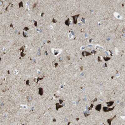 Immunohistochemistry-Paraffin: TMEM234 Antibody [NBP1-90701] - Staining of human cerebral cortex shows strong cytoplasmic positivity in neuronal cells.