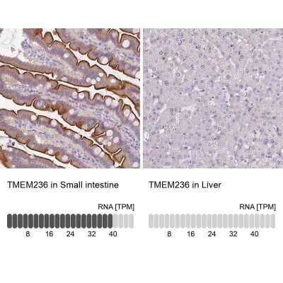 Immunohistochemistry-Paraffin: TMEM236 Antibody [NBP2-62612] - Immunohistochemistry analysis in human small intestine and liver tissues using Anti-TMEM236 antibody. Corresponding TMEM236 RNA-seq data are presented for the same tissues.