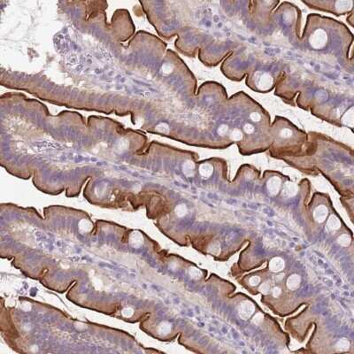 Immunohistochemistry-Paraffin: TMEM236 Antibody [NBP2-62612] - Staining of human small intestine shows high expression.