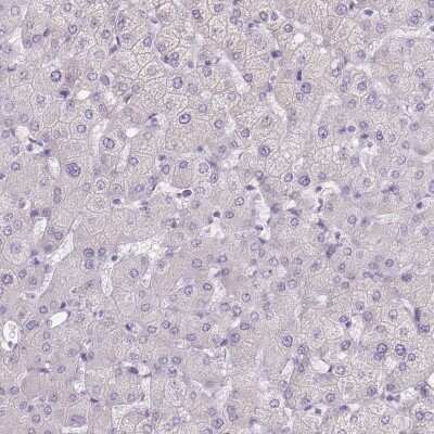 Immunohistochemistry-Paraffin: TMEM236 Antibody [NBP2-62612] - Staining of human liver shows low expression as expected.