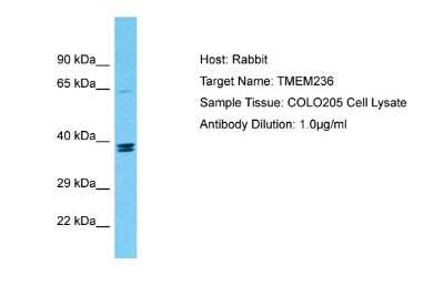 Western Blot: TMEM236 Antibody [NBP2-83687] - Host: Rabbit. Target Name: TMEM236. Sample Tissue: Human COLO205 Whole Cell. Antibody Dilution: 1ug/ml