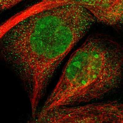 Immunocytochemistry/ Immunofluorescence TMEM24 Antibody