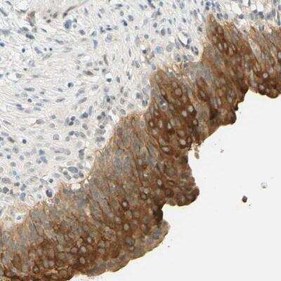 Immunohistochemistry-Paraffin TMEM24 Antibody