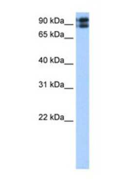 Western Blot: TMEM24 Antibody [NBP1-69582] - This Anti-TMEM24 antibody was used in Western Blot of Transfected 293T tissue lysate at a concentration of 0.5ug/ml.