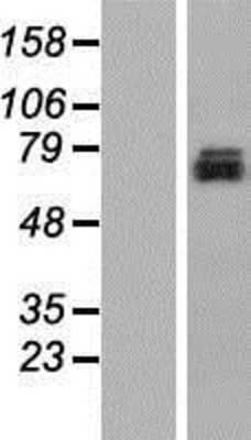 Western Blot: TMEM24 Overexpression Lysate (Adult Normal) [NBP2-10305] Left-Empty vector transfected control cell lysate (HEK293 cell lysate); Right -Over-expression Lysate for TMEM24.