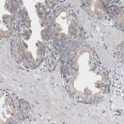 Immunohistochemistry-Paraffin: TMEM242 Antibody [NBP1-88580] - Staining of human prostate shows weak membranous positivity in glandular cells.