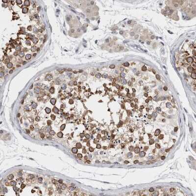 Immunohistochemistry-Paraffin: TMEM242 Antibody [NBP1-88580] - Staining of human testis shows moderate to strong cytoplasmic and membranous positivity in cells in seminiferous ducts.